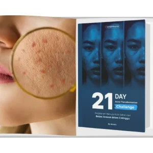 Pelajari ACNEPEDIA sekarang