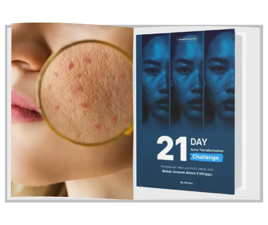 Pelajari ACNEPEDIA sekarang